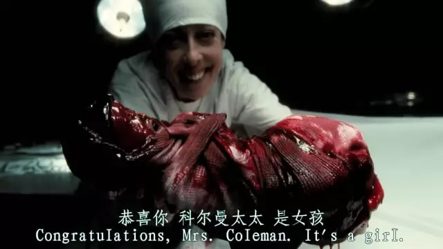 現實版孤兒怨VS電影版《孤兒怨》現實永遠比電影更恐怖，太嚇人了！