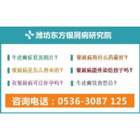 濰坊看銀屑病專業的